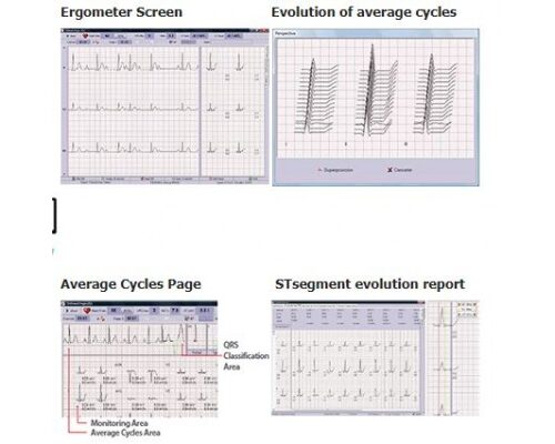 Stress ECG SW TRISMED Stress ECG S/W